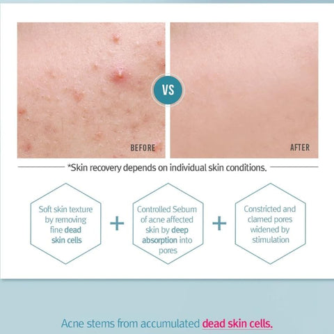 [Pyunkang yul] ACNE TONER 150ml