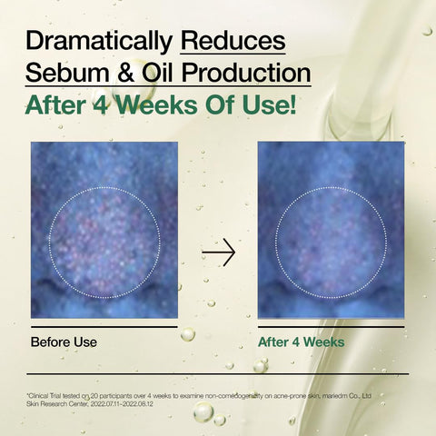 [ANUA] HEARTLEAF PORE CONTROL CLEANSING OIL 200ml