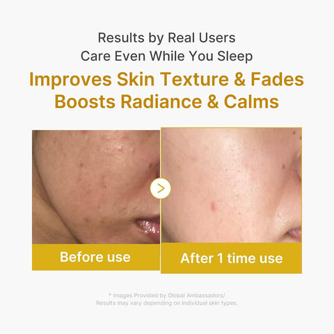 Medicube Kojic Acid Turmeric Night Wrapping Mask 75ml 2.0